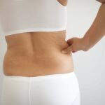 After losing weight, many people are left with excess skin. Here's how you can fix that problem.